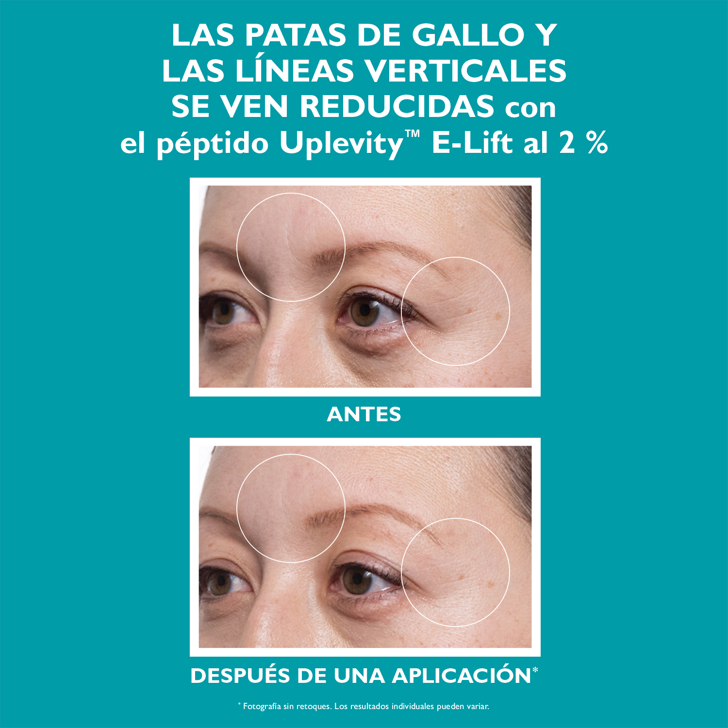 PEPTIDE SKINJECTION HYDRA GEL PATCHES (PARCHES PARA CONTORNO DE OJOS)